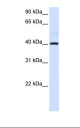GOT2 Antibody - 293T whole cell lysate. Anti-GOT2 Antibody concentration: 1.0 ug/ml.  This image was taken for the unconjugated form of this product. Other forms have not been tested.