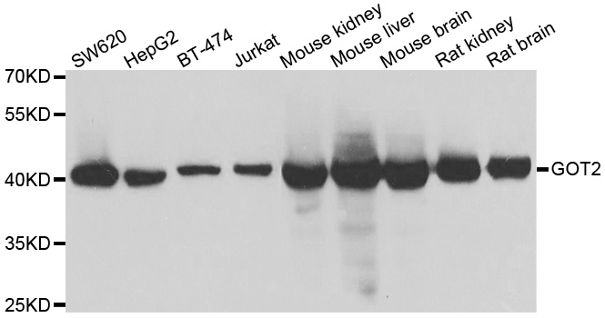 GOT2 Antibody - Western blot analysis of extracts of various cell lines.