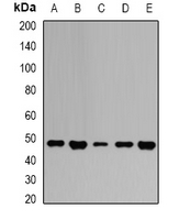 GOT2 Antibody - Western blot analysis of GOT2 expression in HepG2 (A); Jurkat (B); mouse liver (C); mouse brain (D); rat kidney (E) whole cell lysates.