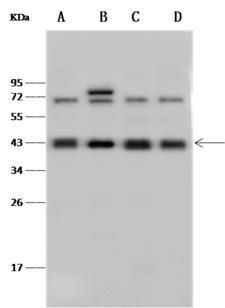 GOT2 Antibody - Anti-GOT2 rabbit polyclonal antibody at 1:500 dilution. Lane A: HeLa Whole Cell Lysate. Lane B: HepG2 Whole Cell Lysate. Lane C: HL60 Whole Cell Lysate. Lane D: 293T Whole Cell Lysate. Lysates/proteins at 30 ug per lane. Secondary: Goat Anti-Rabbit IgG (H+L)/HRP at 1/10000 dilution. Developed using the ECL technique. Performed under reducing conditions. Predicted band size: 48 kDa. Observed band size: 43 kDa.