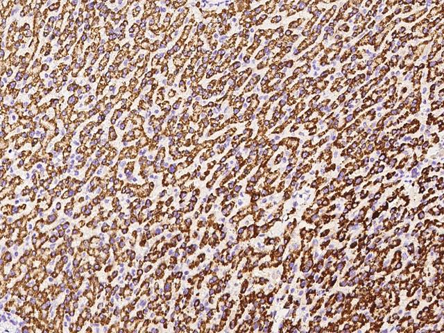 GOT2 Antibody - Immunochemical staining GOT2 in human liver with rabbit polyclonal antibody at 1:1000 dilution, formalin-fixed paraffin embedded sections.