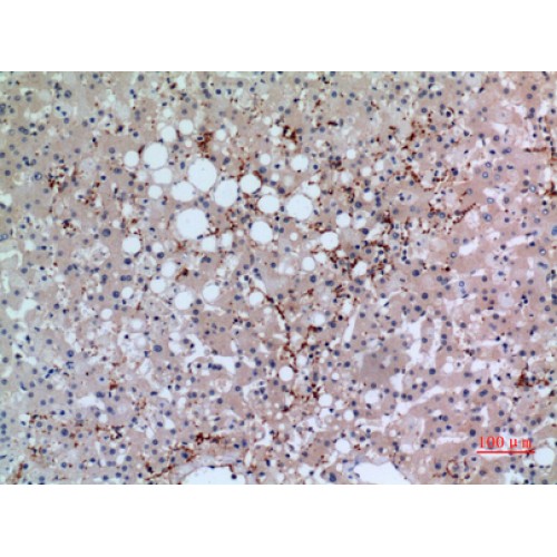 GP1BA / CD42b Antibody - Immunohistochemistry of CD42b antibody