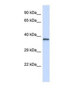 GP1BA / CD42b Antibody - Western blot of Human Jurkat. GP1BA antibody dilution 1.0 ug/ml.  This image was taken for the unconjugated form of this product. Other forms have not been tested.