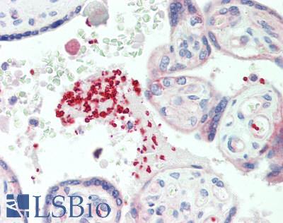 GP1BA / CD42b Antibody - Human Placenta, Platelets: Formalin-Fixed, Paraffin-Embedded (FFPE)