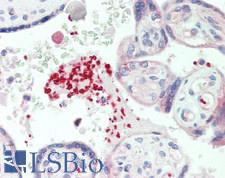 GP1BA / CD42b Antibody - Human Placenta, Platelets: Formalin-Fixed, Paraffin-Embedded (FFPE)