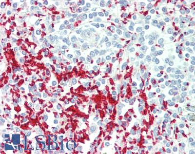 GP1BA / CD42b Antibody - Human Spleen: Formalin-Fixed, Paraffin-Embedded (FFPE)