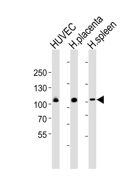 GP1BA / CD42b Antibody - Western blot of lysates from HUVEC cell line , human placenta and spleen tissue lysate (from left to right) with GP1BA (Glycocalicin) Antibody. Antibody was diluted at 1:1000 at each lane. A goat anti-rabbit IgG H&L (HRP) at 1:5000 dilution was used as the secondary antibody. Lysates at 35 ug per lane.