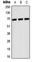 GP1BA / CD42b Antibody - Western blot analysis of CD42b expression in HeLa (A); NIH3T3 (B); H9C2 (C) whole cell lysates.