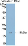 GP1BB / CD42c Antibody - Western blot of recombinant GP1BB / CD42c.  This image was taken for the unconjugated form of this product. Other forms have not been tested.