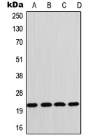 GP1BB / CD42c Antibody - Western blot analysis of CD42c expression in Raji (A); HL60 (B); SP2/0 (C); rat heart (D) whole cell lysates.