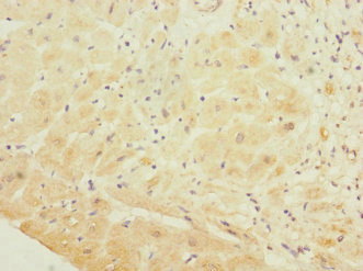 GP1BB / CD42c Antibody - Immunohistochemistry of paraffin-embedded human heart tissue at dilution 1:100