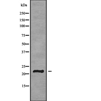 GP1BB / CD42c Antibody - Western blot analysis GP1BB using HeLa whole cells lysates