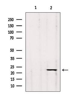 GP1BB / CD42c Antibody - Western blot analysis of extracts of c476 using GP1BB antibody. Lane 1 was treated with the blocking peptide.