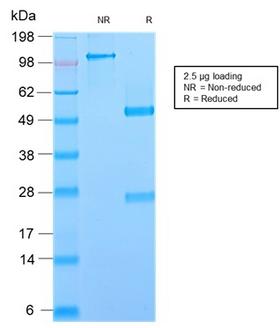 GP2 Antibody - SDS-PAGE Analysis Purified GP2 Recombinant Rabbit Monoclonal Antibody (GP2/2569R). Confirmation of Purity and Integrity of Antibody.