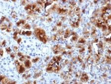 GP2 Antibody - IHC testing of FFPE human pancreas with GP2 antibody (clone GP2/1712). HIER: boil tissue sections in 10mM Tris with 1mM EDTA, pH 9, for 10-20 min.