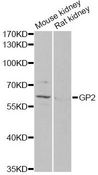 GP2 Antibody - Western blot analysis of extracts of various cell lines, using GP2 antibody at 1:1000 dilution. The secondary antibody used was an HRP Goat Anti-Rabbit IgG (H+L) at 1:10000 dilution. Lysates were loaded 25ug per lane and 3% nonfat dry milk in TBST was used for blocking. An ECL Kit was used for detection and the exposure time was 90s.