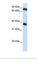 GP6 / GPVI Antibody - Jurkat cell lysate. Antibody concentration: 1.0 ug/ml. Gel concentration: 12%.  This image was taken for the unconjugated form of this product. Other forms have not been tested.