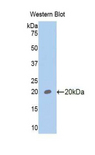 GP6 / GPVI Antibody - Western blot of recombinant GP6 / GPVI.  This image was taken for the unconjugated form of this product. Other forms have not been tested.