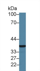 GP6 / GPVI Antibody - Western Blot; Sample: Human Jurkat cell lysate; Primary Ab: 1.5µg/ml Rabbit Anti-Human GP6 Antibody Second Ab: 0.2µg/mL HRP-Linked Caprine Anti-Rabbit IgG Polyclonal Antibody