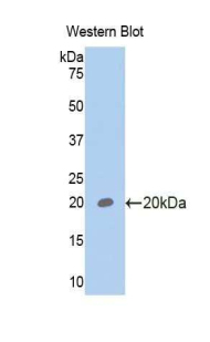 GP6 / GPVI Antibody - Western blot of recombinant GP6 / GPVI.  This image was taken for the unconjugated form of this product. Other forms have not been tested.