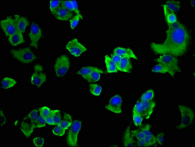 GP6 / GPVI Antibody - Immunofluorescence staining of MCF-7 cells with GP6 Antibody at 1:200, counter-stained with DAPI. The cells were fixed in 4% formaldehyde, permeabilized using 0.2% Triton X-100 and blocked in 10% normal Goat Serum. The cells were then incubated with the antibody overnight at 4°C. The secondary antibody was Alexa Fluor 488-congugated AffiniPure Goat Anti-Rabbit IgG(H+L).
