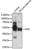 GP6 / GPVI Antibody - Western blot analysis of extracts of various cell lines, using GP6 antibody at 1:1000 dilution. The secondary antibody used was an HRP Goat Anti-Rabbit IgG (H+L) at 1:10000 dilution. Lysates were loaded 25ug per lane and 3% nonfat dry milk in TBST was used for blocking. An ECL Kit was used for detection and the exposure time was 30s.
