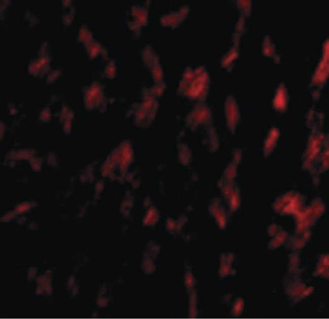 GP6 / GPVI Antibody - Immunofluorescence of GPVI in Human Heart cells with GPVI antibody at 20 ug/ml.