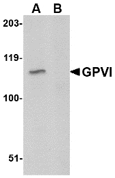 GP6 / GPVI Antibody - Western blot of GPVI in A20 lysate with GPVI antibody at 1 ug/m in either the absence or (B) the presence of blocking peptide.
