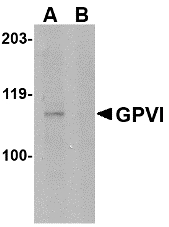 GP6 / GPVI Antibody - Western blot of GPVI in mouse brain lysate with GPVI antibody at 1 ug/ml in either the absence or (B) the presence of blocking peptide.