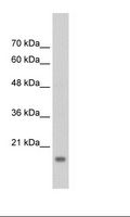 GP78 / AMFR Antibody - HepG2 Cell Lysate.  This image was taken for the unconjugated form of this product. Other forms have not been tested.