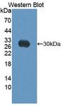 GP78 / AMFR Antibody - Western blot of GP78 / AMFR antibody.