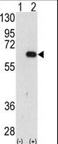 GP78 / AMFR Antibody - Western blot of AMFR (arrow) using AMFR Antibody. 293 cell lysates (2 ug/lane) either nontransfected (Lane 1) or transiently transfected with the AMFR gene (Lane 2) (Origene Technologies).