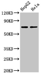 GP78 / AMFR Antibody - Positive Western Blot detected in HepG2 whole cell lysate, Hela whole cell lysatee. All lanes: AMFR antibody at 4 µg/ml Secondary Goat polyclonal to rabbit IgG at 1/50000 dilution. Predicted band size: 73 KDa. Observed band size: 73 KDa