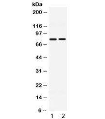 GP78 / AMFR Antibody - Western blot testing of 1) rat thymus and 2) human HeLa lysate with GP78 antibody at 0.5ug/ml. Predicted molecular weight ~73 kDa, commonly observed at ~78 kDa.