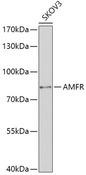 GP78 / AMFR Antibody - Western blot analysis of extracts of SKOV3 cells using AMFR Polyclonal Antibody at dilution of 1:1000.