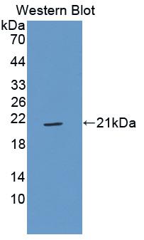 GP9 / CD42a Antibody - Western blot of GP9 / CD42a antibody.