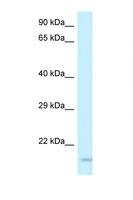 GP9 / CD42a Antibody - GP9 / CD42a antibody Western blot of ACHN Cell lysate. Antibody concentration 1 ug/ml.  This image was taken for the unconjugated form of this product. Other forms have not been tested.