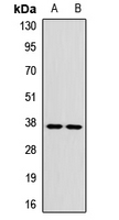 GP9 / CD42a Antibody
