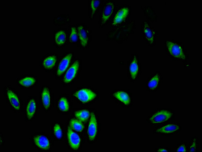 GP9 / CD42a Antibody - Immunofluorescent analysis of A549 cells at a dilution of 1:100 and Alexa Fluor 488-congugated AffiniPure Goat Anti-Rabbit IgG(H+L)