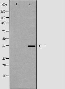 GP9 / CD42a Antibody - Western blot analysis of MCF-7 cell lysates using GP9 antibody. The lane on the left is treated with the antigen-specific peptide.
