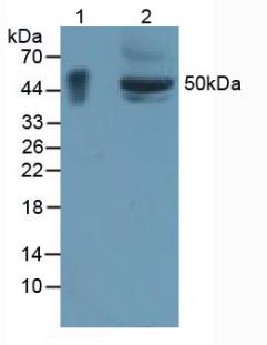 GPA33 / A33 Antibody - Western Blot; Sample: Lane1: Rat Large Intestine Tissue; Lane2: Mouse Small Intestine Tissue.
