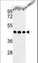 GPA33 / A33 Antibody - Western blot of GPA33 Antibody in K562, 293, MDA-MB231 cell line lysates (35 ug/lane). GPA33 (arrow) was detected using the purified antibody.