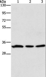 GPA33 / A33 Antibody - Western blot analysis of 293T and human colon cancer tissue, 231 cell, using GPA33 Polyclonal Antibody at dilution of 1:600.