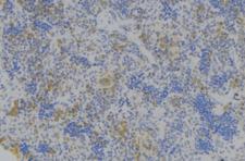 GPA33 / A33 Antibody - 1:100 staining human lymph node tissue by IHC-P. The sample was formaldehyde fixed and a heat mediated antigen retrieval step in citrate buffer was performed. The sample was then blocked and incubated with the antibody for 1.5 hours at 22°C. An HRP conjugated goat anti-rabbit antibody was used as the secondary.