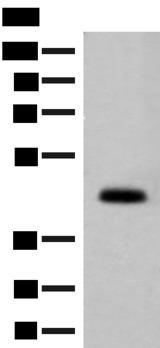 GPA33 / A33 Antibody - Western blot analysis of Mouse small intestines tissue lysate  using GPA33 Polyclonal Antibody at dilution of 1:200