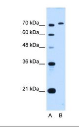 GPAA1 Antibody - Lane A: Marker. Lane B: HepG2 cell lysate. Antibody concentration: 0.5 ug/ml. Gel concentration: 12%.  This image was taken for the unconjugated form of this product. Other forms have not been tested.