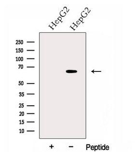 GPAA1 Antibody - Western blot analysis of extracts of HepG2 cells using GPAA1 antibody. The lane on the left was treated with blocking peptide.