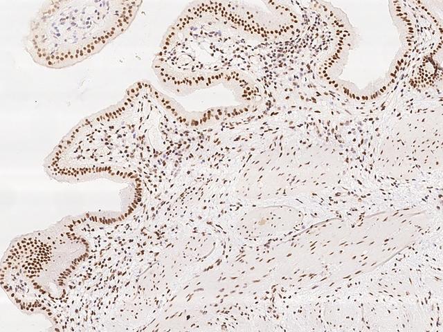GPALPP1 / KIAA1704 Antibody - Immunochemical staining of human GPALPP1 in human gallbladder with rabbit polyclonal antibody at 1:300 dilution, formalin-fixed paraffin embedded sections.