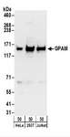 GPAM Antibody - Detection of Human GPAM by Western Blot. Samples: Whole cell lysate (50 ug) from HeLa, 293T, and Jurkat cells. Antibodies: Affinity purified rabbit anti-GPAM antibody used for WB at 1 ug/ml. Detection: Chemiluminescence with an exposure time of 30 seconds.