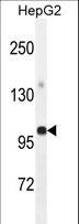 GPAM Antibody - GPAM Antibody western blot of HepG2 cell line lysates (35 ug/lane). The GPAM antibody detected the GPAM protein (arrow).